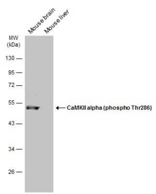 Western Blot: CaM Kinase II alpha [p Thr286] Antibody [NBP3-13299]